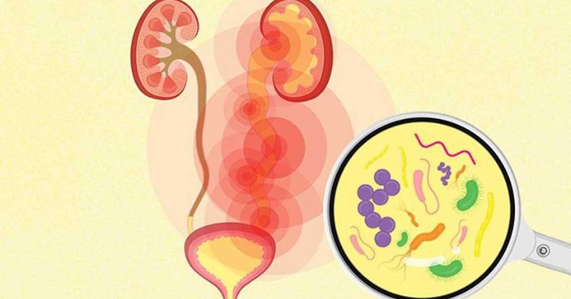 Nhiễm trùng đường tiết niệu
