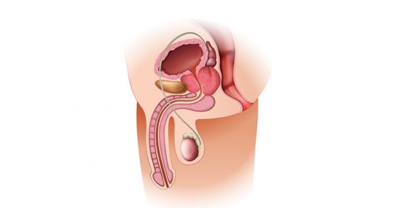 Rối loạn cương dương