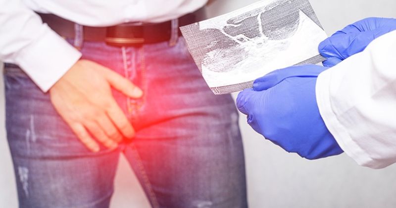 Xoắn tinh hoàn được chẩn đoán như thế nào